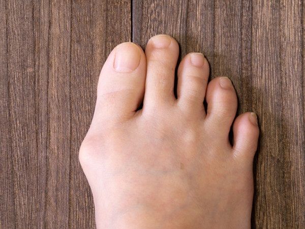 外反母趾の意外な原因とは 足指じゃんけん で足の機能不全をチェック 理学療法士が解説 ハルメク365 女性の足 の悩みで常に上位にランクインする ｄメニューニュース Nttドコモ