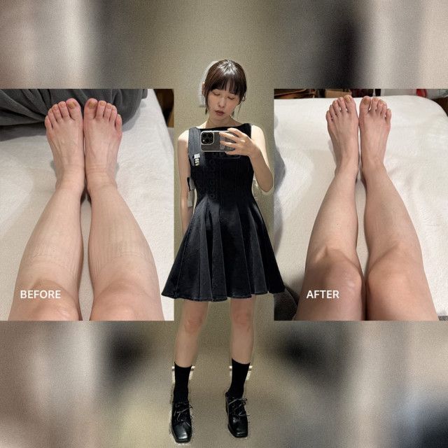 夏のむくみ対策】劇的に脚が細くなる！ 美容マニア・アダチミカ
