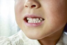 子どもが“鼻水”なめる癖、健康にどう影響？　やめさせるには？　対策を看護師に聞く