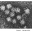 夏にノロ 広島の飲食店で集団食中毒