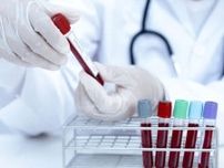 若年性大腸がんが「血液」で検査可能になる？リキッドバイオプシーの最新研究