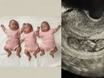23歳で双子を妊娠、医師から「3人かもしれない」と…三つ子ママ（26）が明かす、15人の厳戒態勢で行われた“計画出産”