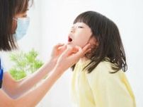 子どもの「お口ぽかん」には、“舌の使い方”のトレーニングが有効　歯科医師に聞く「口腔機能発達不全症」の治療法