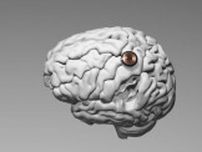 イーロン・マスク氏「人間の脳にニューラリンクのチップを埋め込んだ」と発表！