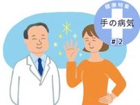 更年期以降に急増！手指の痛み・変形・こわばり…読者の悩みに医師が回答