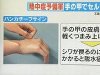 5秒でできる 熱中症「セルフチェック」 前段階の“脱水症”を見抜くことがポイント  ①爪を押す ➁手の甲をつまむ