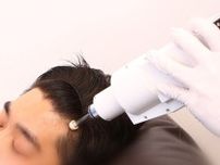 【美容のプロが注目する 薄毛ケア】日本初！“針なし注射”で皮下まで薬剤を注入できる「超注目の最新発毛治療」とは？