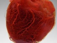 解説：マイクロプラスチックと心臓発作や脳卒中が関連、初の証拠