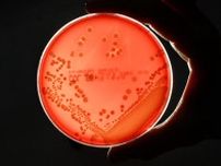 今や菌に薬が効かない「ポスト抗生物質」時代に、年500万人死亡