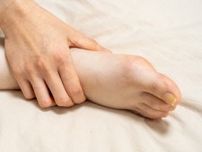 足の「ウオノメ」は治療を受けた方がいいのでしょうか？【日本版「足病医」が足のトラブル解決】