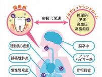 「腸活」の盲点は口腔ケア　お口の中の悪玉菌が腸内環境に影響