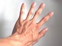 手や腕の血管、なぜ浮き出る？　病気の可能性は？　4つの原因を医師に聞く