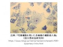 40代女性1人が「細菌性赤痢」と診断　岡山県内で今年度初