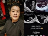 “19歳年下妻が妊娠”俳優リュ・シウォン、12週目になる赤ちゃん“クンクン”の超音波公開